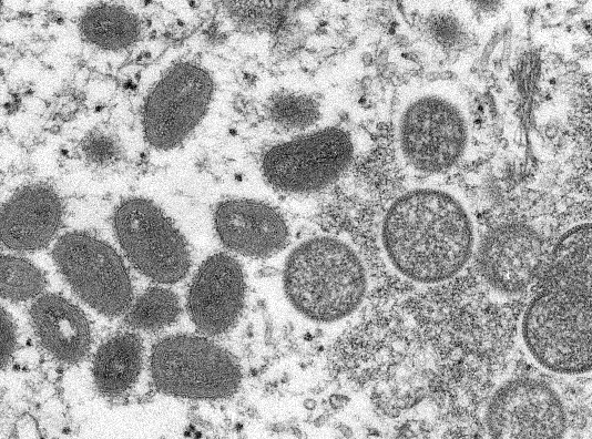 Microscopic photo of viruses