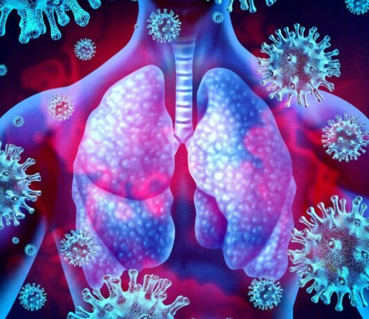 Artist rendering of hman lungs surrounded by viruses